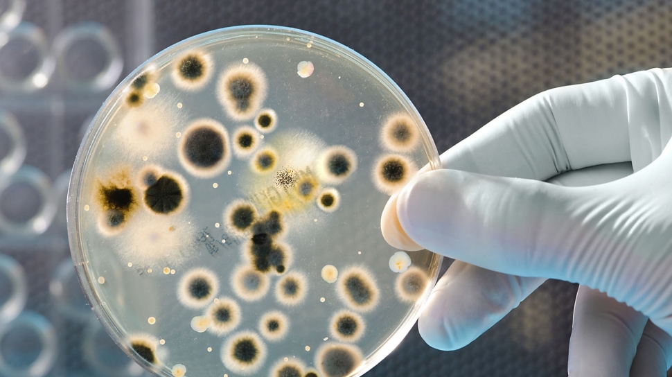 Kasus Resistensi Antimikroba Paling Parah Terjadi di Negara Berpenghasilan Rendah dan Menengah