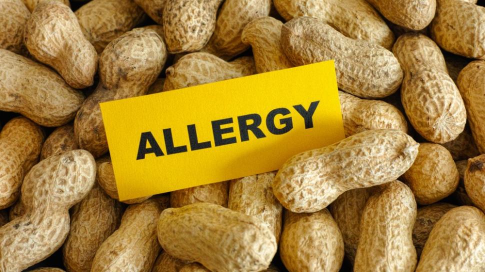 Studi: Alergi Kacang pada Anak Balita Dapat Diobati dengan Imunoterapi Oral
