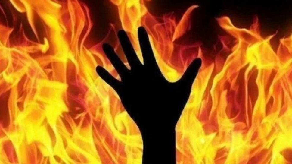 Viral Mahasiswa Jogja Dibakar Hidup-hidup oleh Teman Sendiri: Apa yang Terjadi saat Tubuh Terbakar?