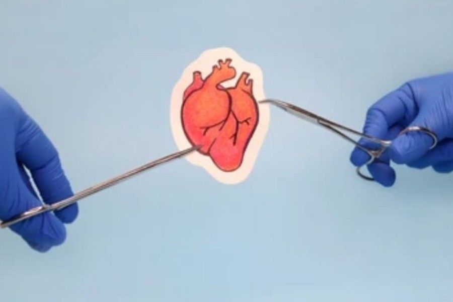 Ilustrasi transplantasi jantung. [Dok.Antara]
