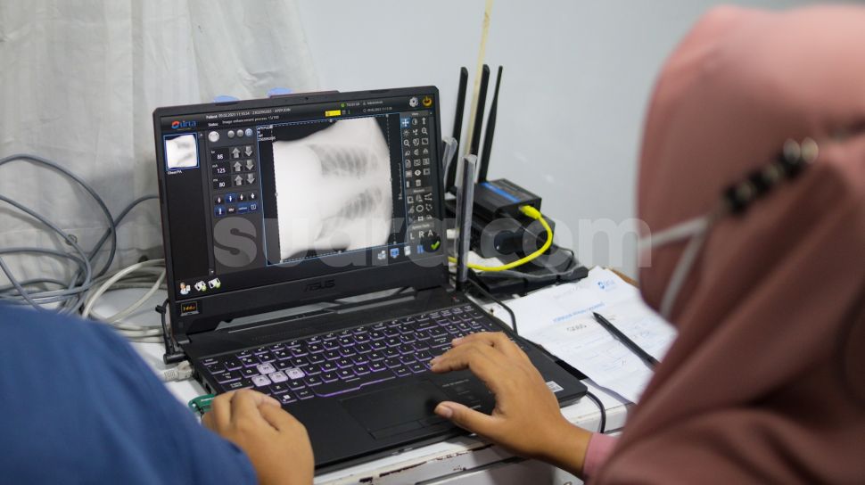 Indonesia Peringkat Kedua Jumlah Kasus Tuberkulosis Terbanyak di Dunia, Biang Kerok Penularannya Apa?