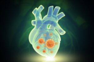 Mengenal Terapi Resinkronisasi Jantung, Cara Pasien Gagal Jantung untuk Bisa Hidup Normal